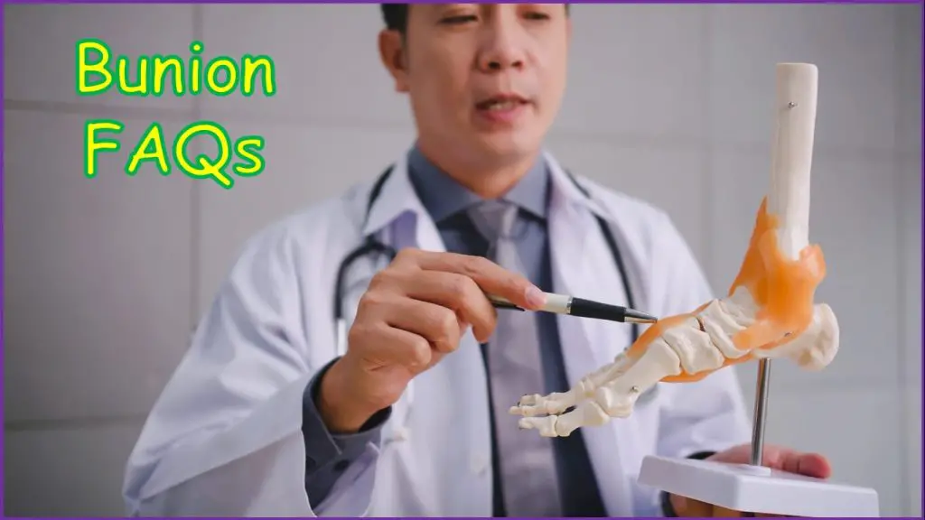 Bunion FAQs
