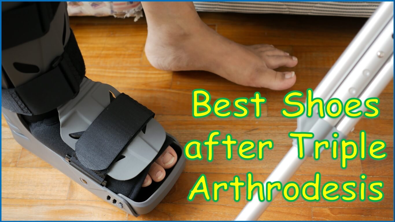 Best Shoes after Triple Arthrodesis