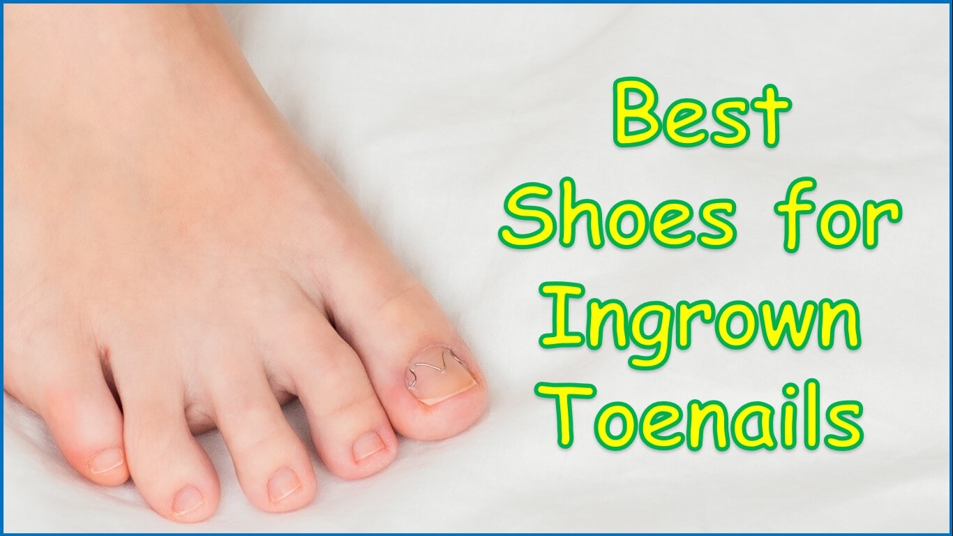 Best Shoes for Ingrown Toenails | ingrown toenail better fitting footwear | best sneakers for ingrown toenails