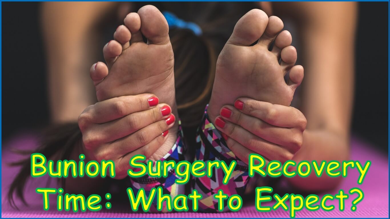 bunion surgery recovery time