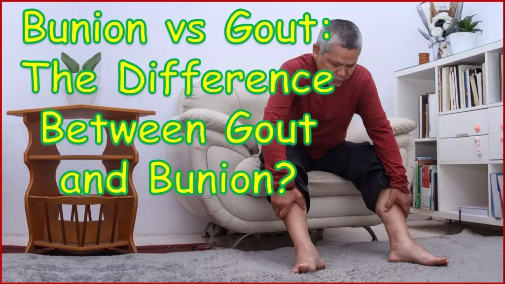 Bunion vs Gout | The Difference Between Gout and Bunion | bunion vs gout