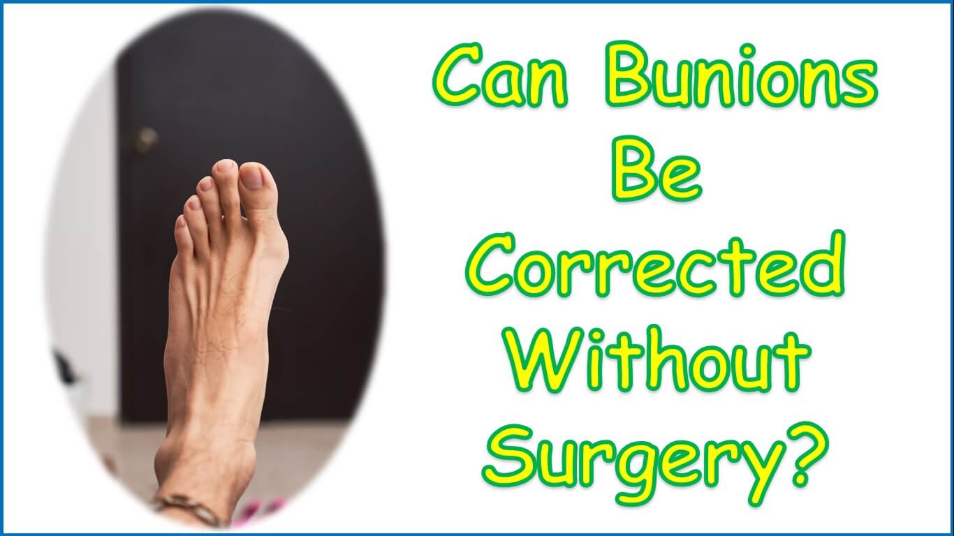 Can Bunions Be Corrected Without Surgery | can bunions be fixed without surgery