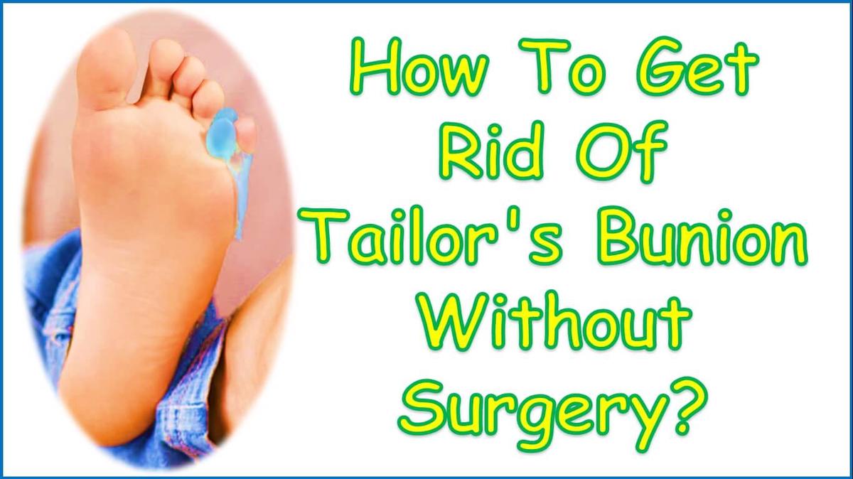 How To Get Rid Of Tailor's Bunion Without Surgery?