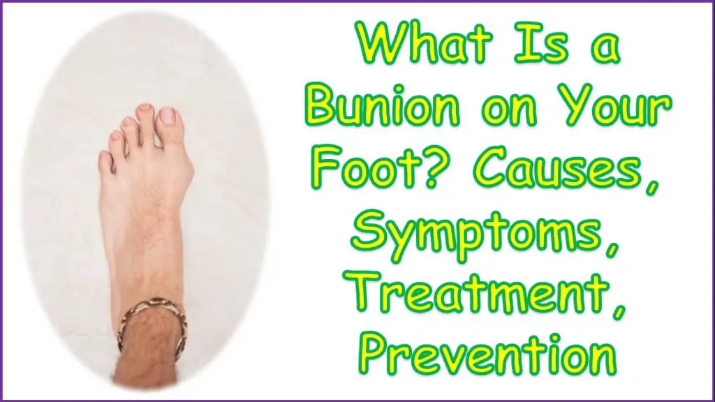 What Is a Bunion on Your Foot | what is a bunion on your foot look like | what causes a bunion on your foot