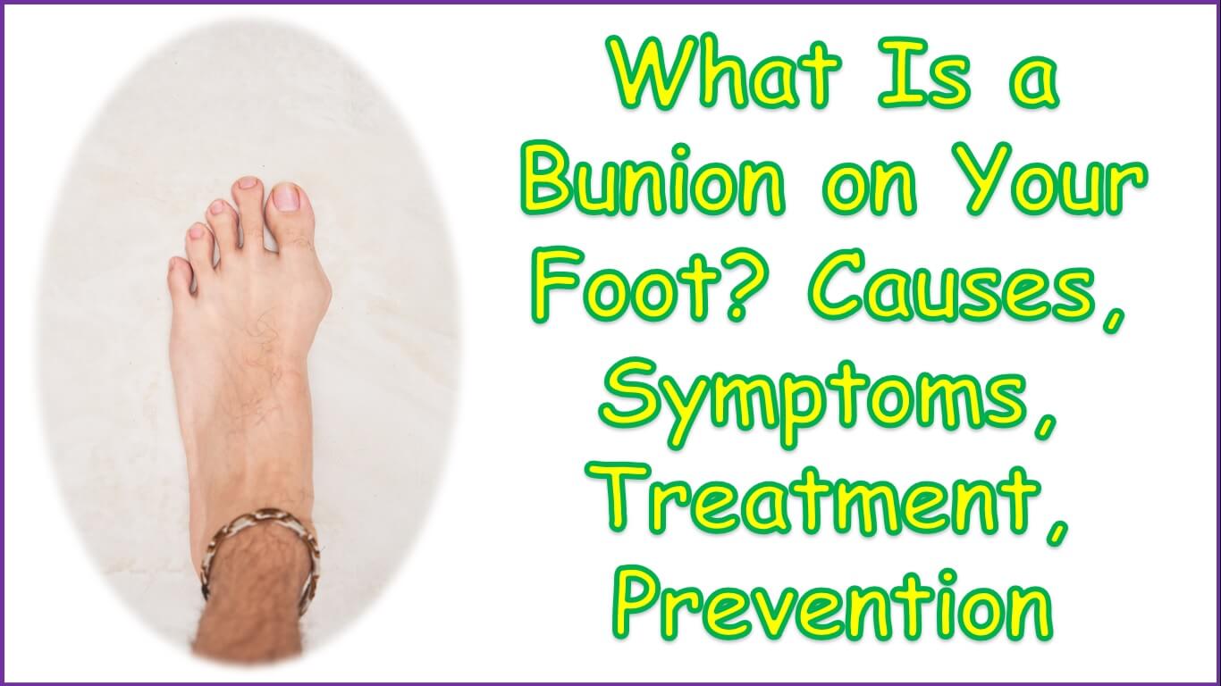 What Is a Bunion on Your Foot