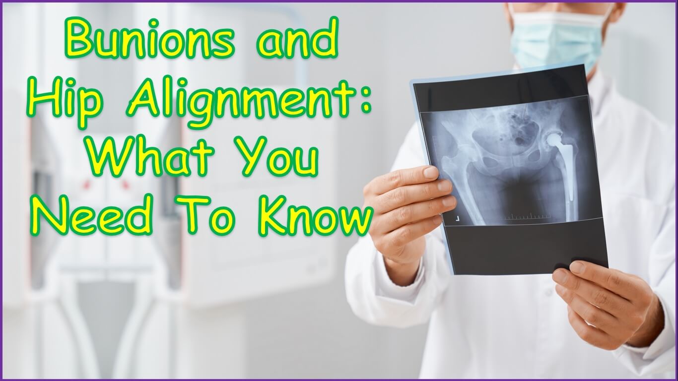 Bunions and Hip Alignment
