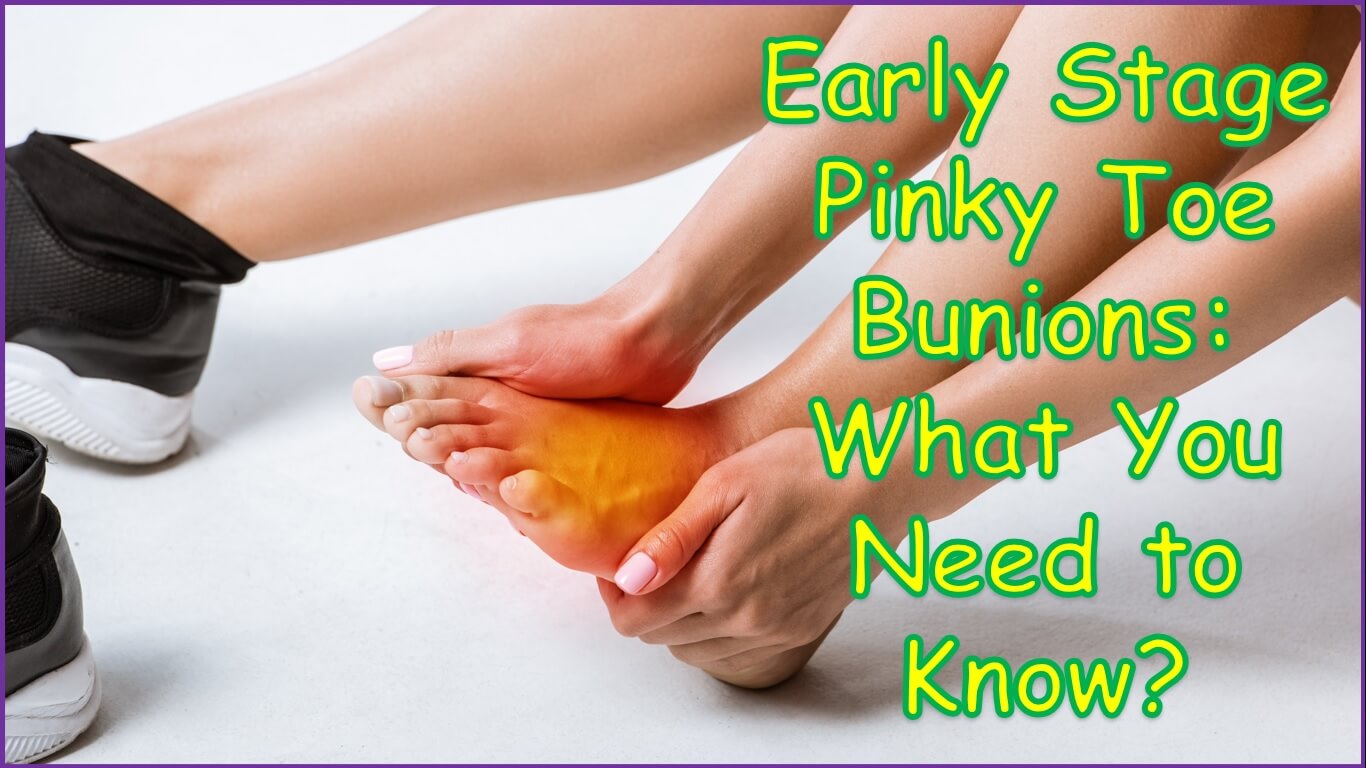 Early Stage Pinky Toe Bunions