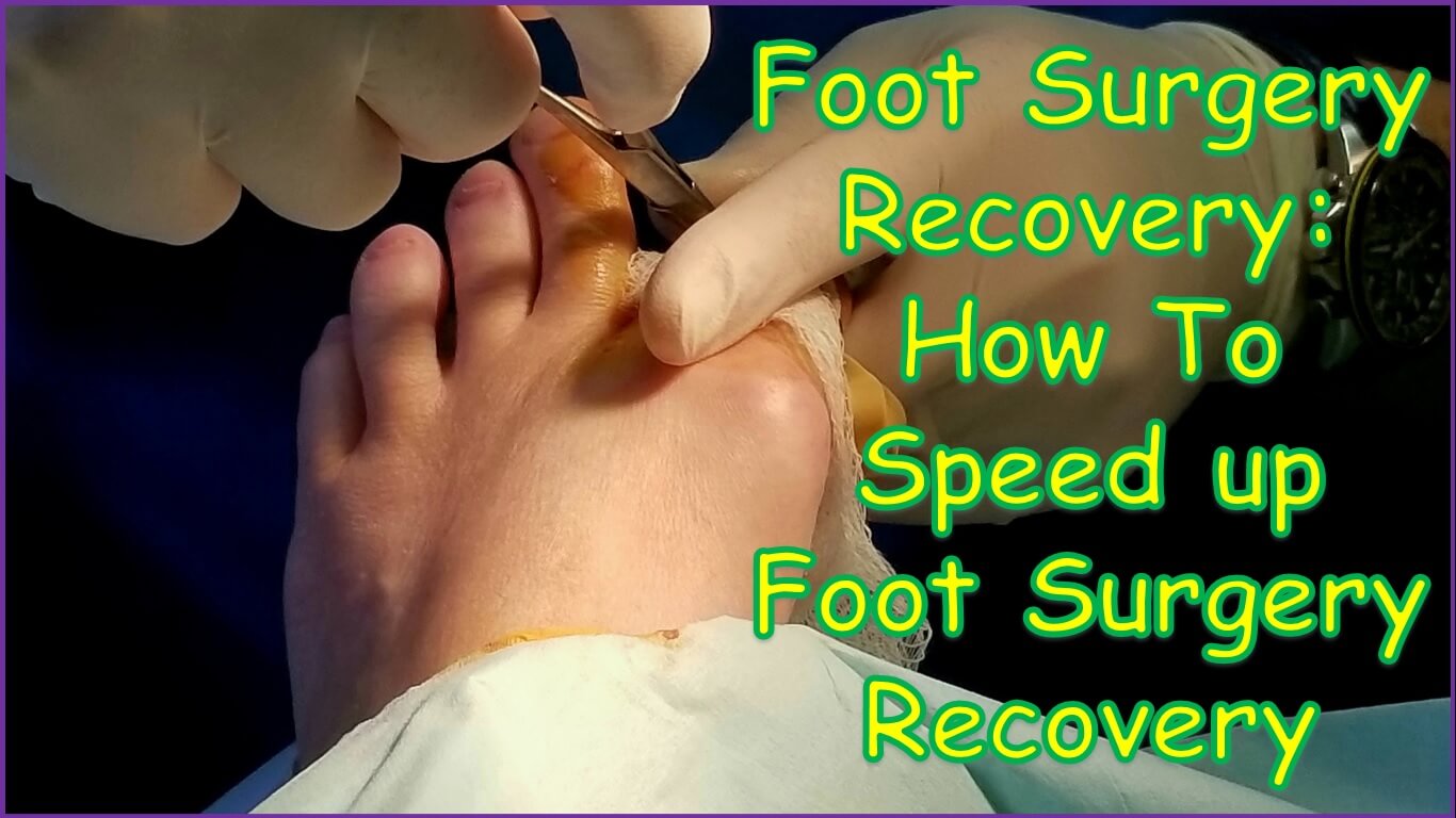 Foot Surgery Recovery