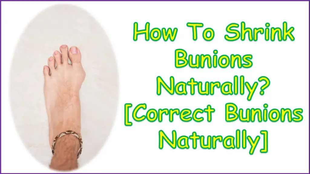 How To Shrink Bunions Naturally | Correct Bunions Naturally | How can i shrink my bunions naturally?