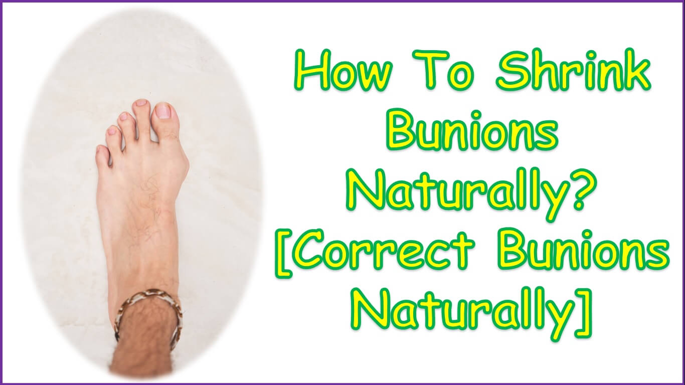 How To Shrink Bunions Naturally