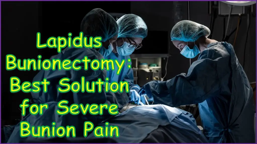 Lapidus Bunionectomy | cpt code for lapidus bunionectomy | lapidus bunionectomy cpt