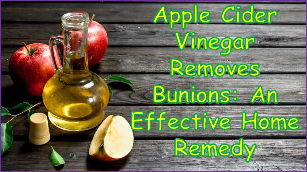 Apple Cider Vinegar Removes Bunions | how to naturally get rid of a bunion | natural remedies for bunions | apple cider vinegar for calluses