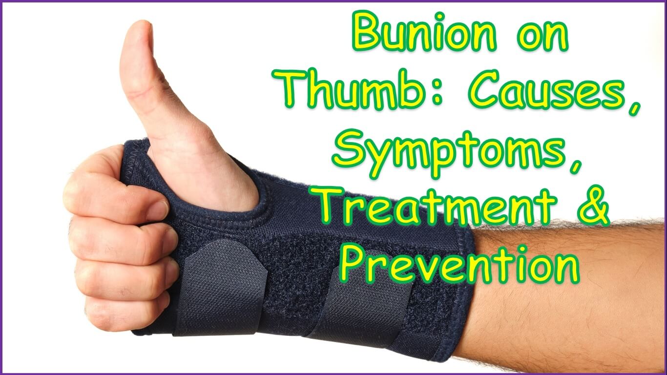 Bunion on Thumb