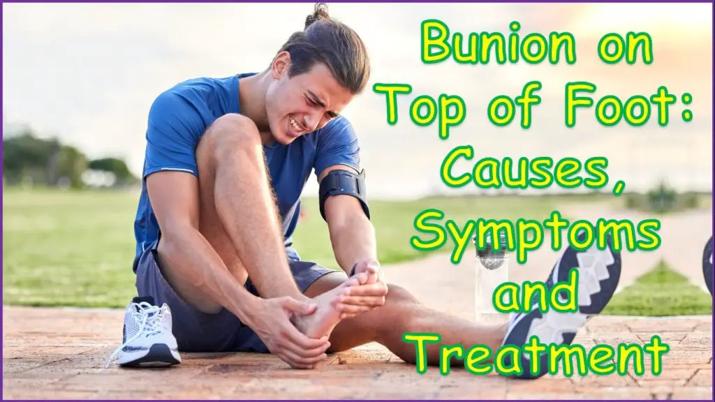 Bunion on Top of Foot | can bunions cause pain on top of foot | bunion on top of big toe | pain on top of foot after bunion surgery