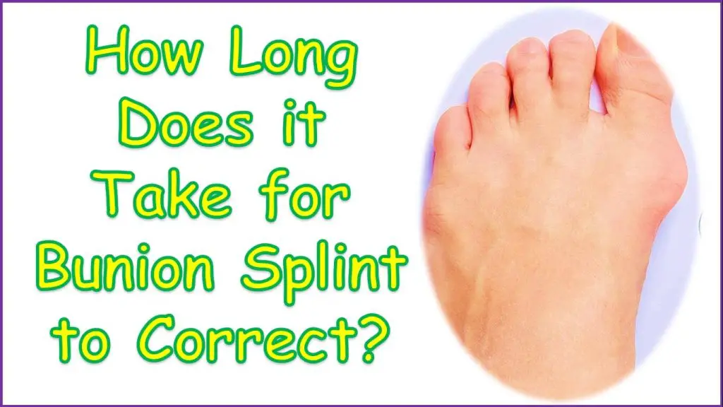 How Long Does it Take for Bunion Splint to Correct | how long do you have to wear a bunion corrector