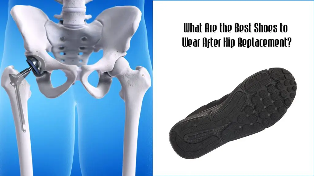 What Are the Best Shoes to Wear After Hip Replacement