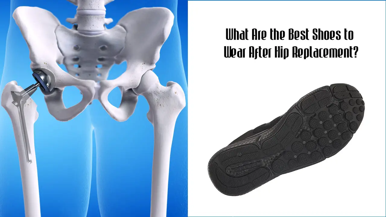 What Are the Best Shoes to Wear After Hip Replacement